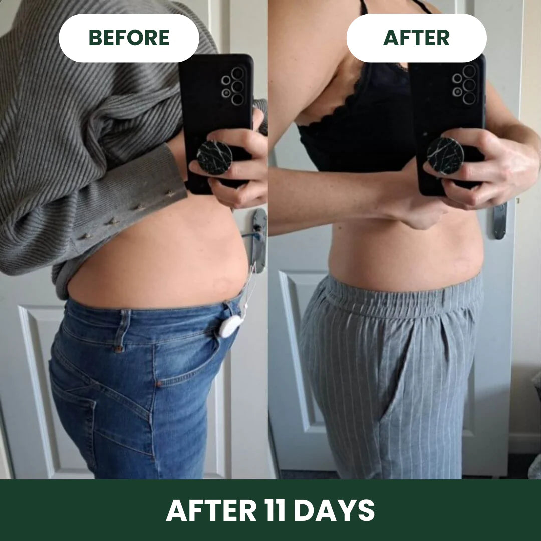 DigestEase™ Digestive Enzymes
