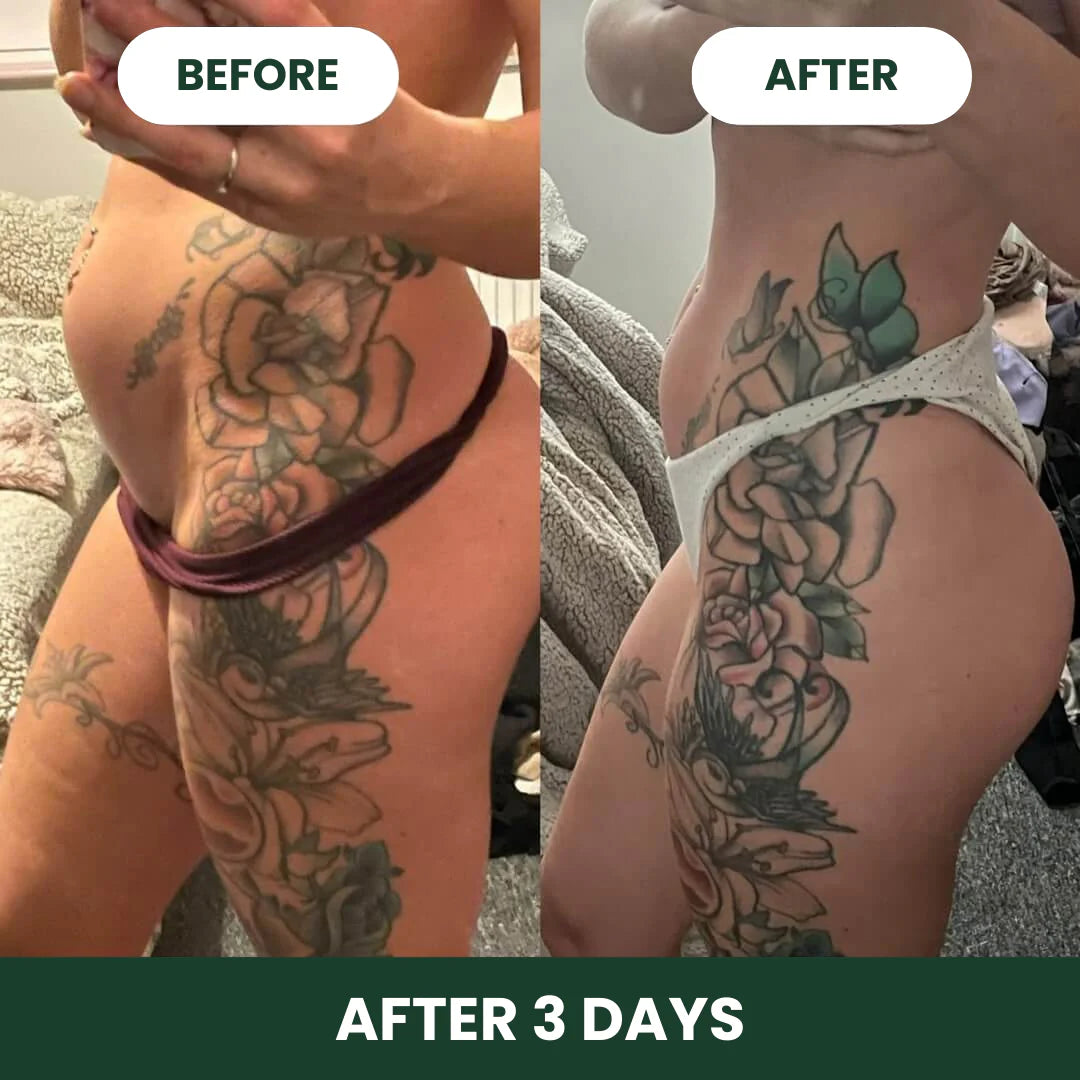 DigestEase™ Digestive Enzymes