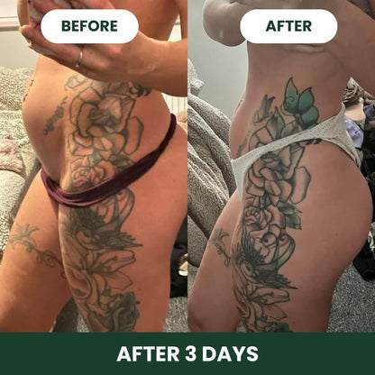 DigestEase™ Digestive Enzymes